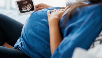 Pregnant woman looking at sonogram
