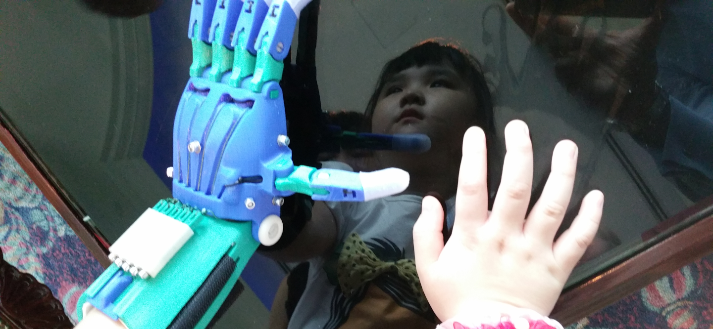 A photo of Kai Lei showing her 3-D printed left hand and natural right hand