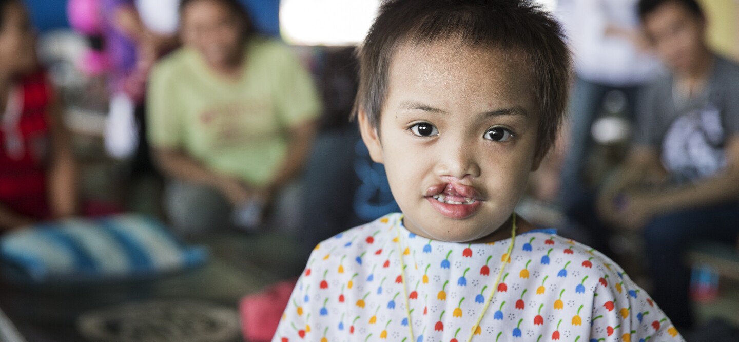 読む だけで募金ができる 見た目 に悩む 口唇裂 口蓋裂 私たちにできること ジョンソン エンド ジョンソン 読む だけで募金ができる 見た目 に悩む 口唇裂 口蓋裂 私たちにできること ジョンソン エンド ジョンソン